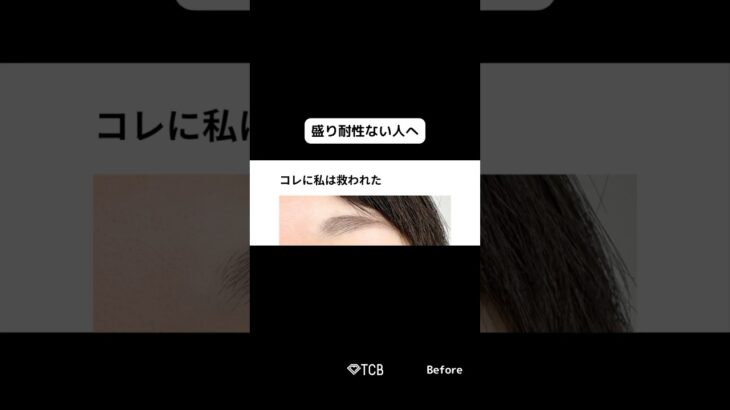 【二重整形】ナチュラルメイクで無双🥴　#shorts
